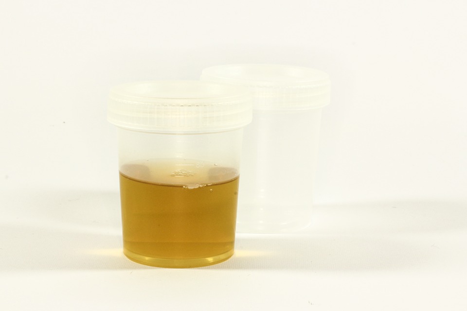 Is Urine Sterile? And Other Questions About Using Pee in First Aid